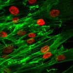 Onko kuva kehon sisä- vai -ulkopuolelta? Ne ovat samannäköisiä.