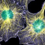 Onko kuva kehon sisä- vai -ulkopuolelta? Ne ovat samannäköisiä.