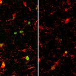 Onko kuva kehon sisä- vai -ulkopuolelta? Ne ovat samannäköisiä.